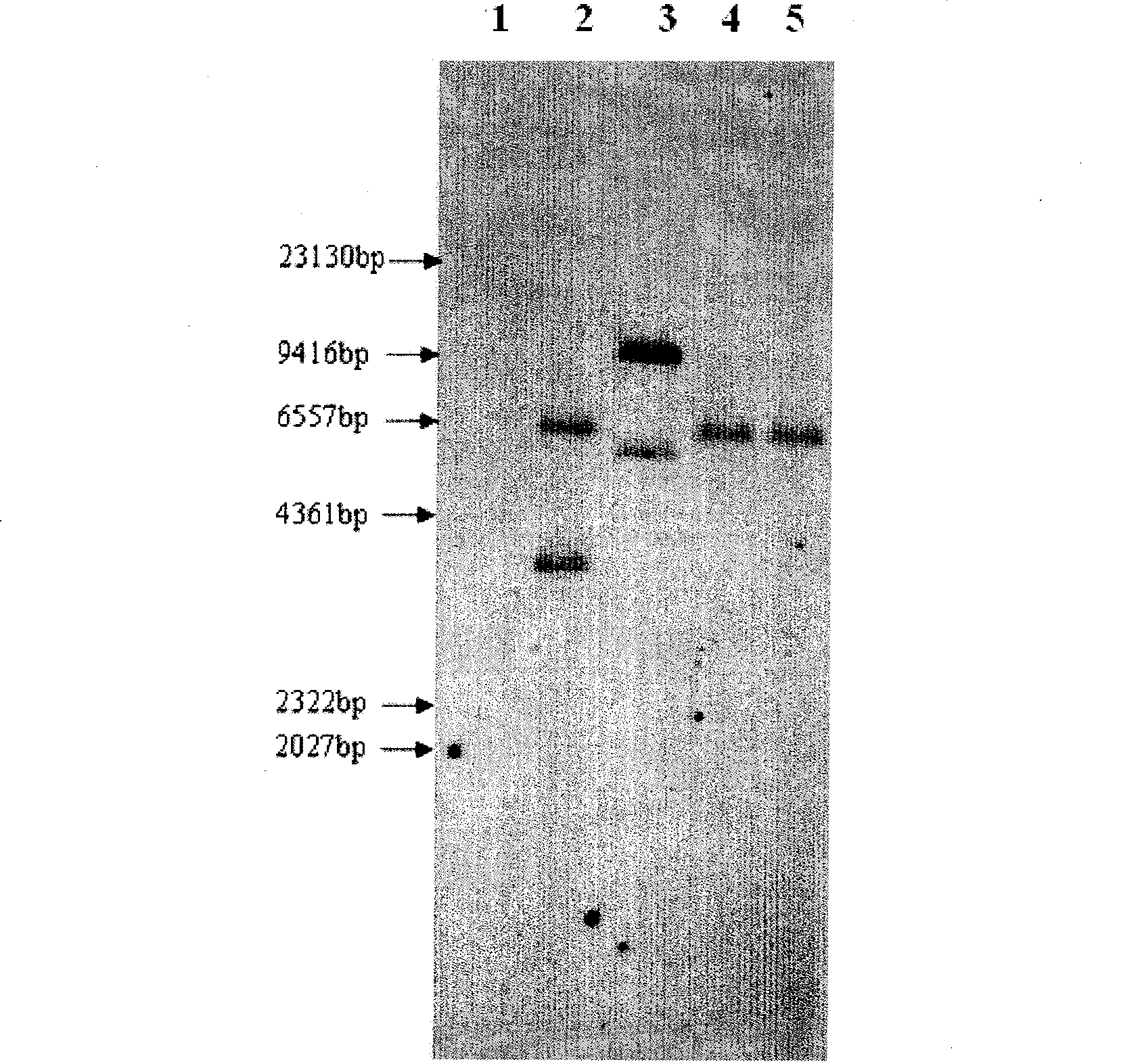 4 connecting body thymosin alpha 1 gene order and preparation method of transgene tomato