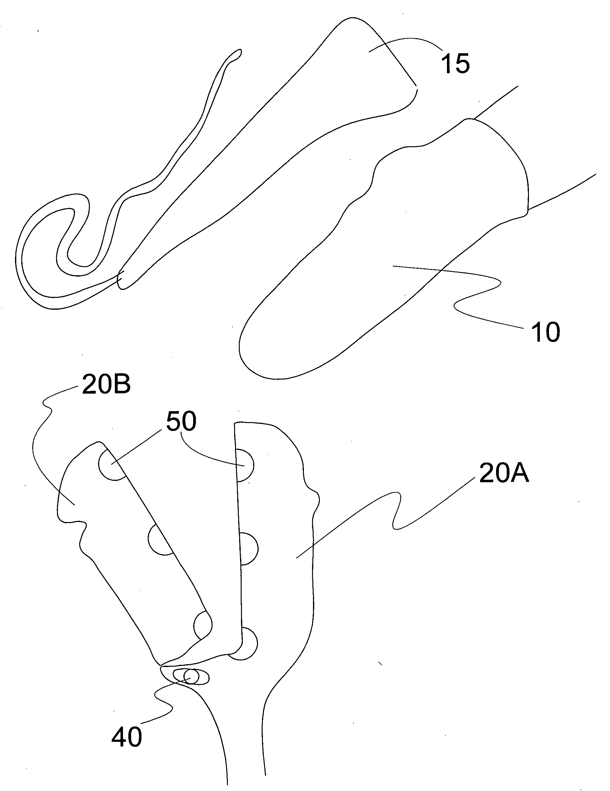 Elastomeric stump sock for suspending by friction an artificial limb