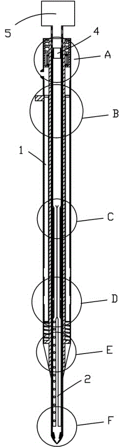 Comprehensive treatment system for ruminant ruminal tympany