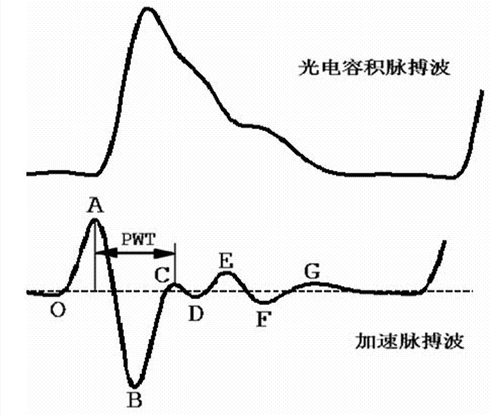 Calculation method for extracting conduction time from pulse wave