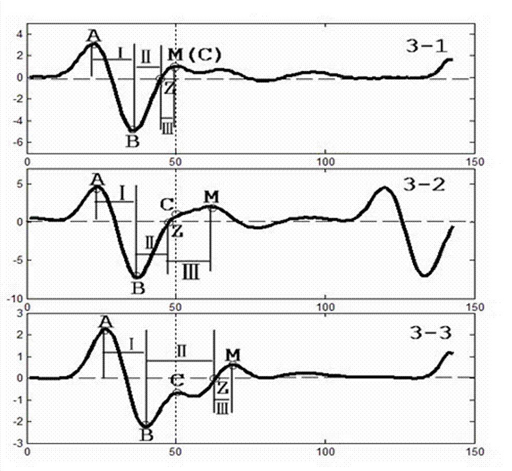 Calculation method for extracting conduction time from pulse wave