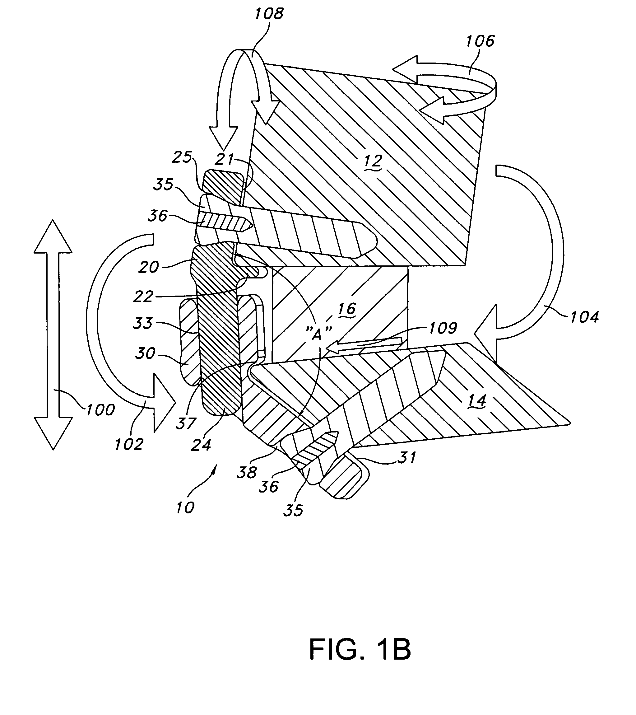 Dynamic stabilization device for anterior lower lumbar vertebral fusion