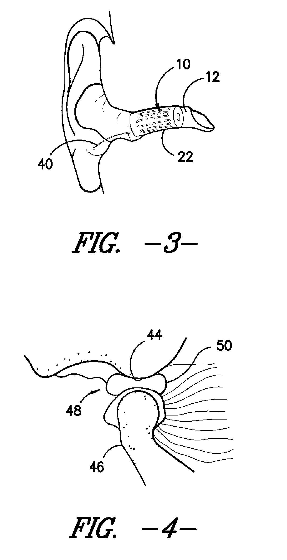 Ear insert for relief of TMJ discomfort and headaches