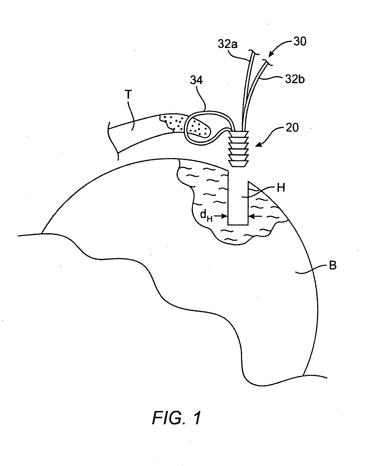 Suture passer devices and uses thereof