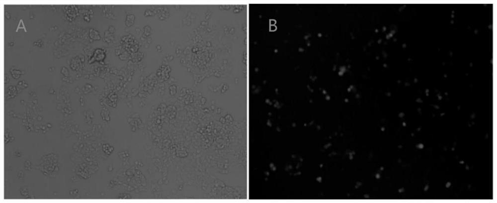 TEM-1 targeted gene vaccine and construction and application thereof