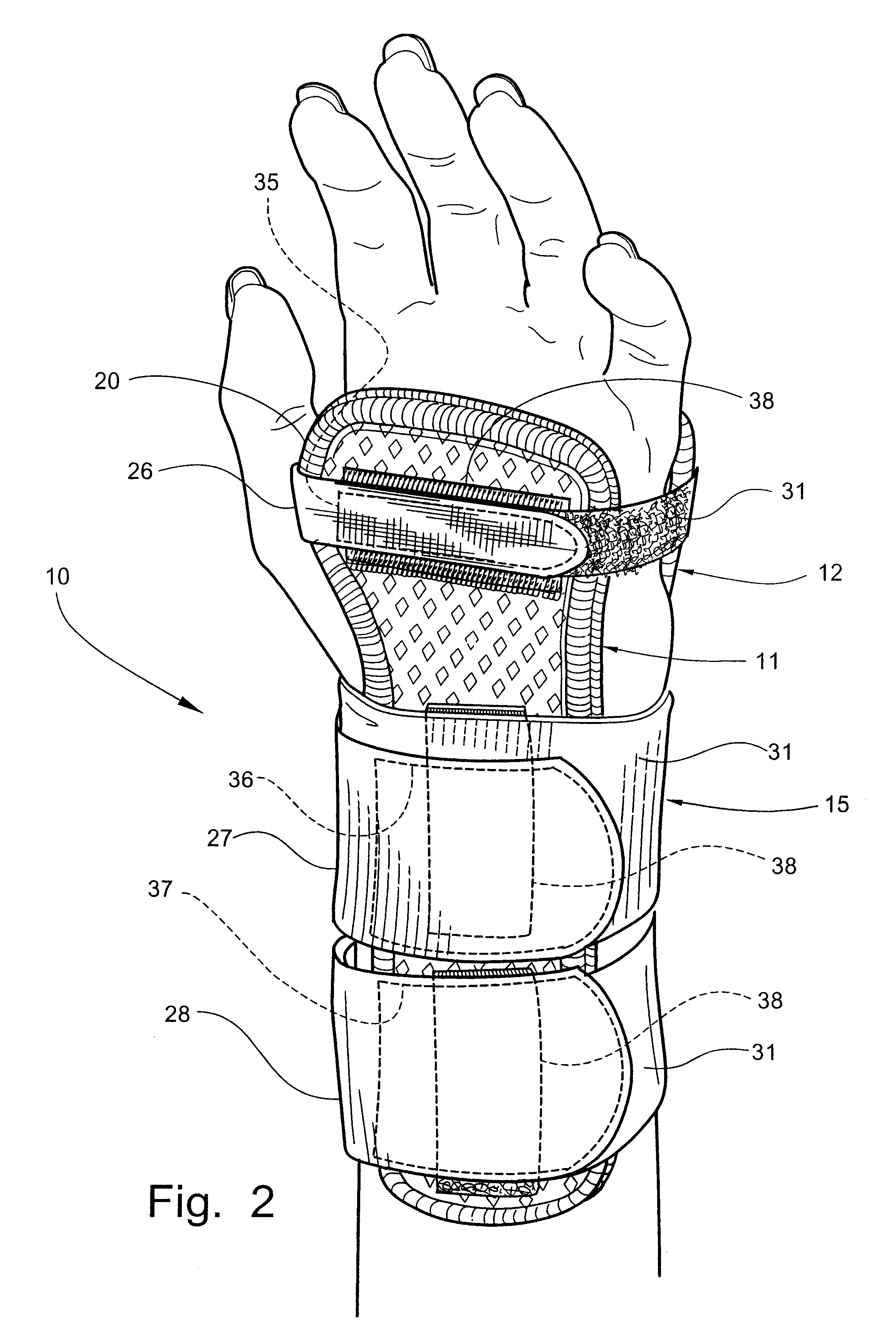 Custom-moldable wrist splint