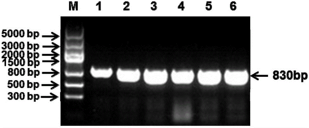 Universal kit for detecting different genotypes of infectious bronchitis viruses