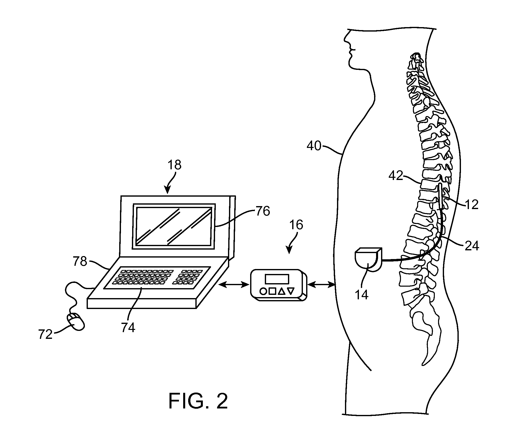 Neurostimulation system for defining a generalized ideal multipole configuration