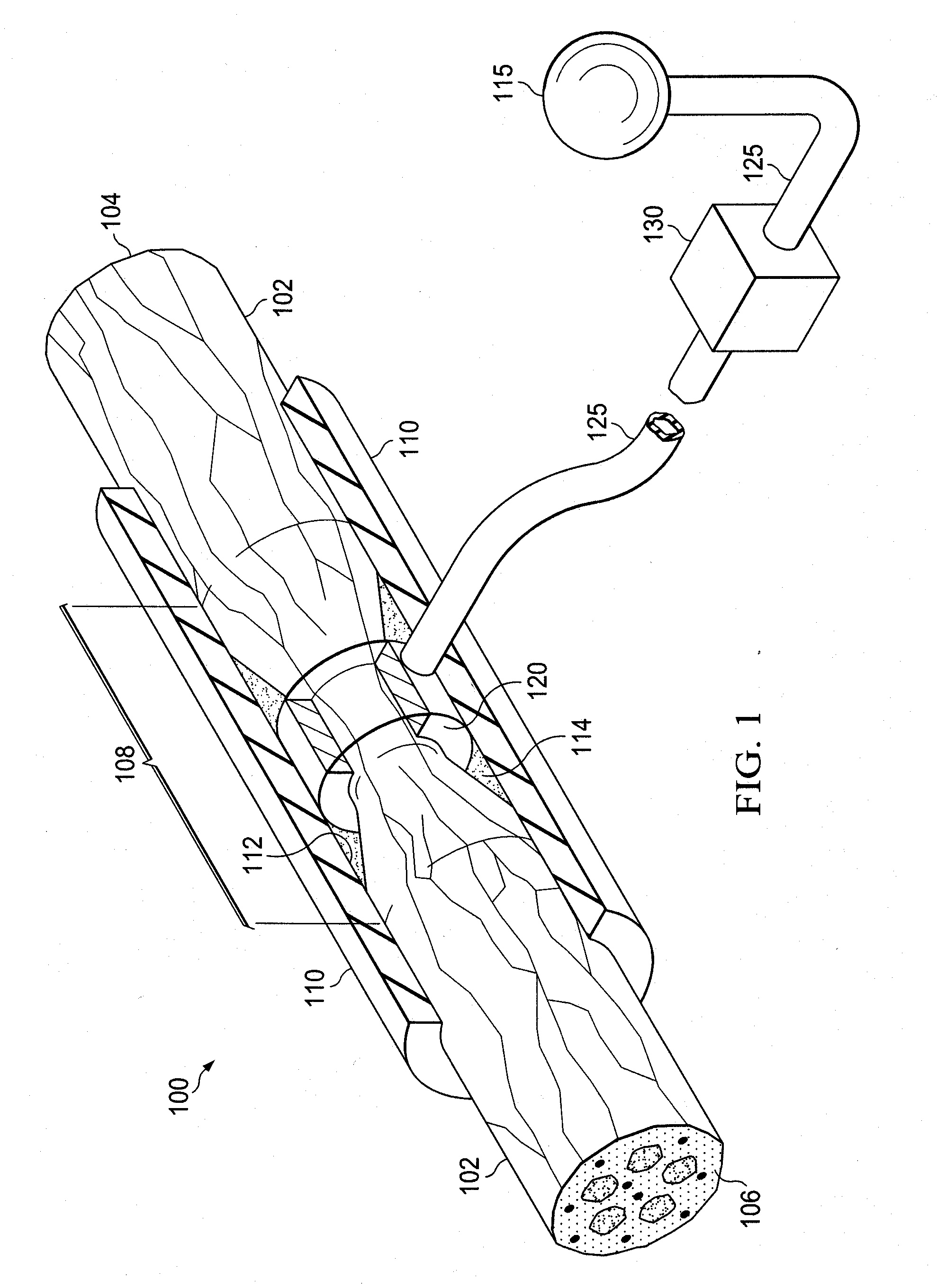 System for providing fluid flow to nerve tissues