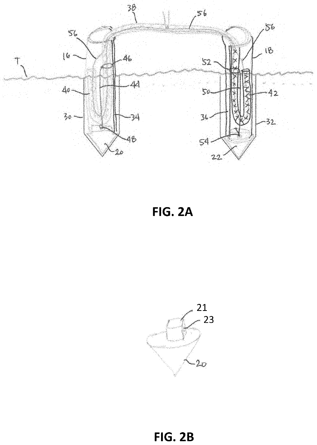 Soft suture staple system with tethered anchoring mechanism