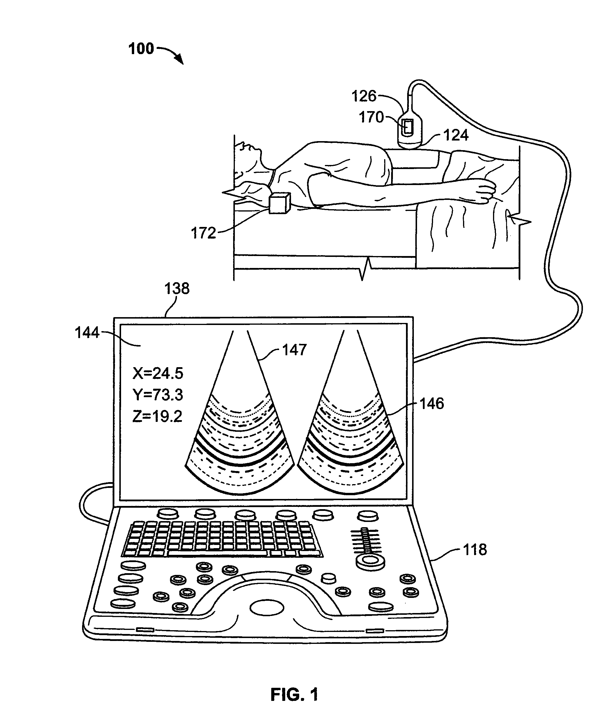 Methods and systems for display of shear-wave elastography  and strain elastography images