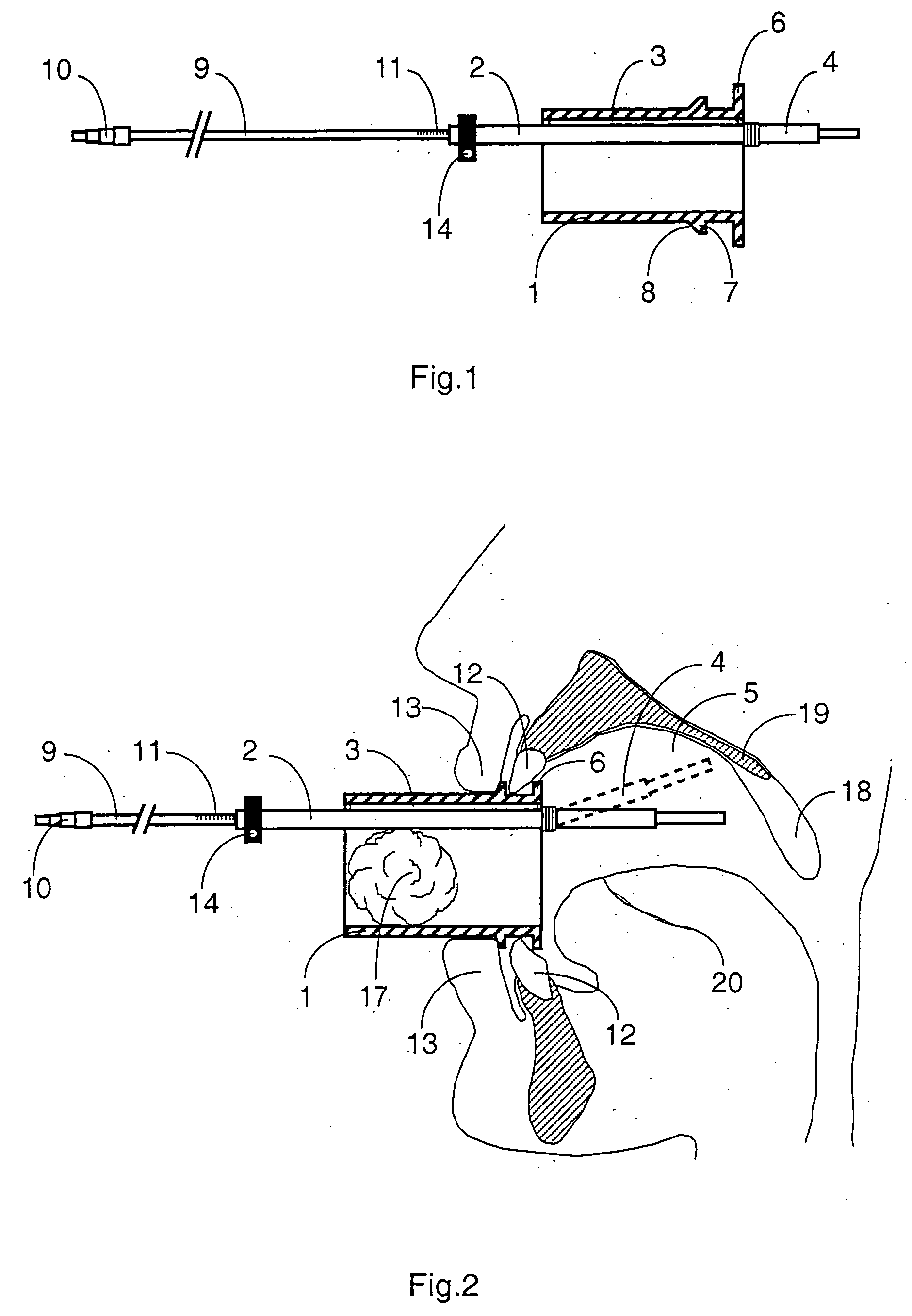 Mouthpeice intended for a device used to assess the sensitivity of the pharynx and a device comprising same