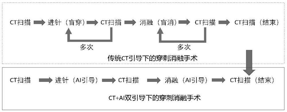 Navigation system in puncture ablation under CT and AI dual guidance