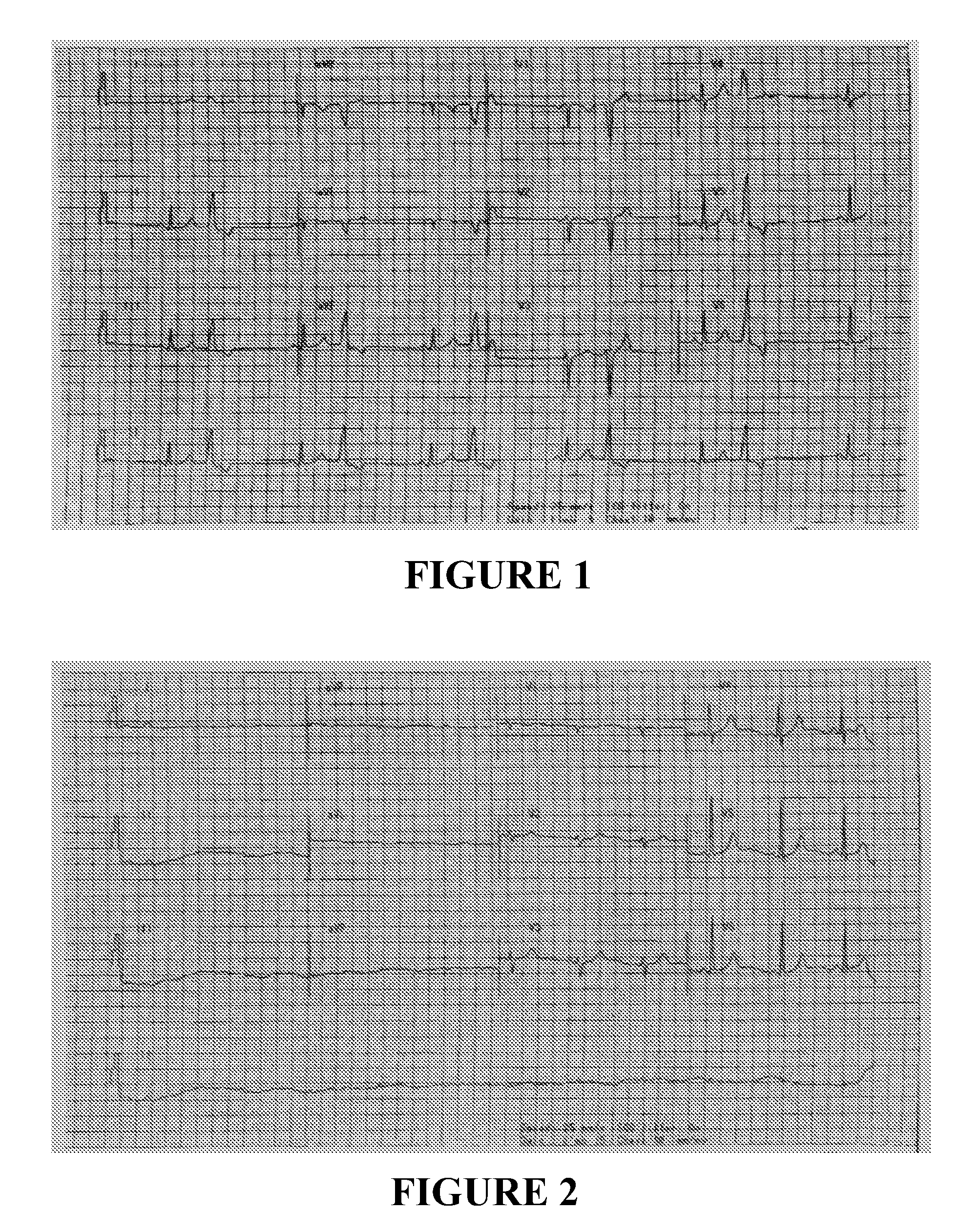 Compositions comprising inosine and orotic acid and methods of use thereof for the treatment of certain heart conditions and enhancement of work capacity