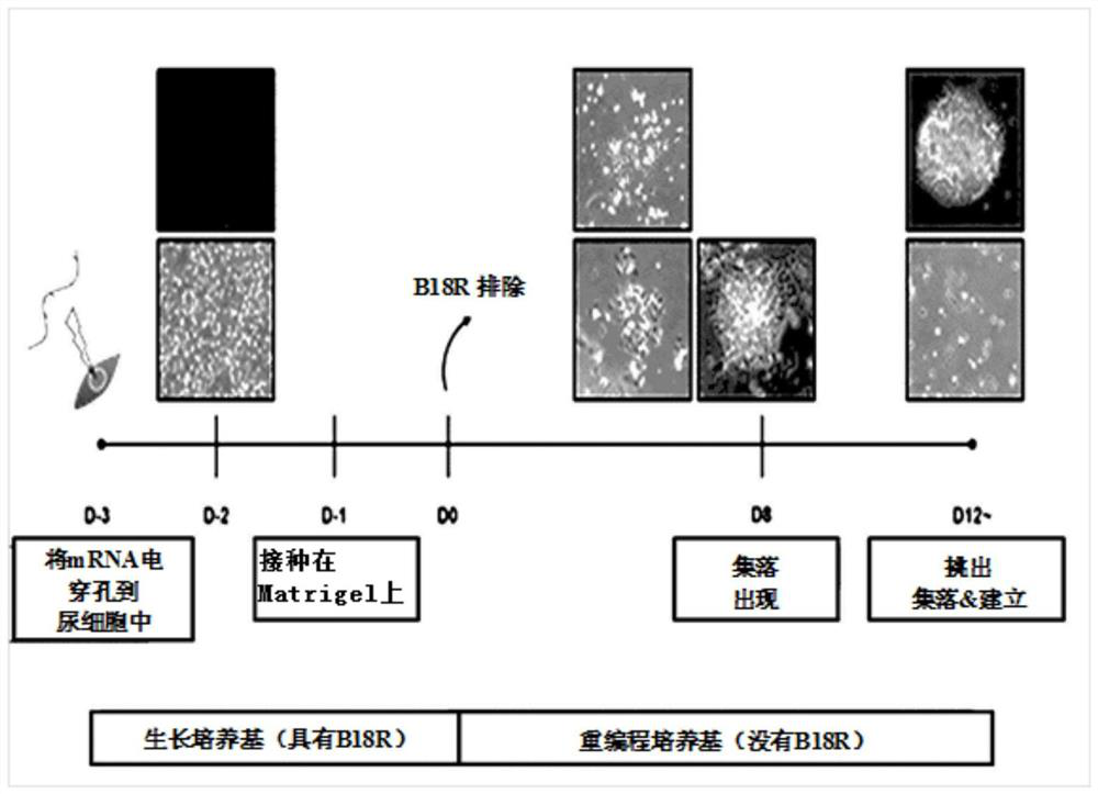 Direct de-differentiation of urine cell into nueral stem cell using synthetic messenger RNA