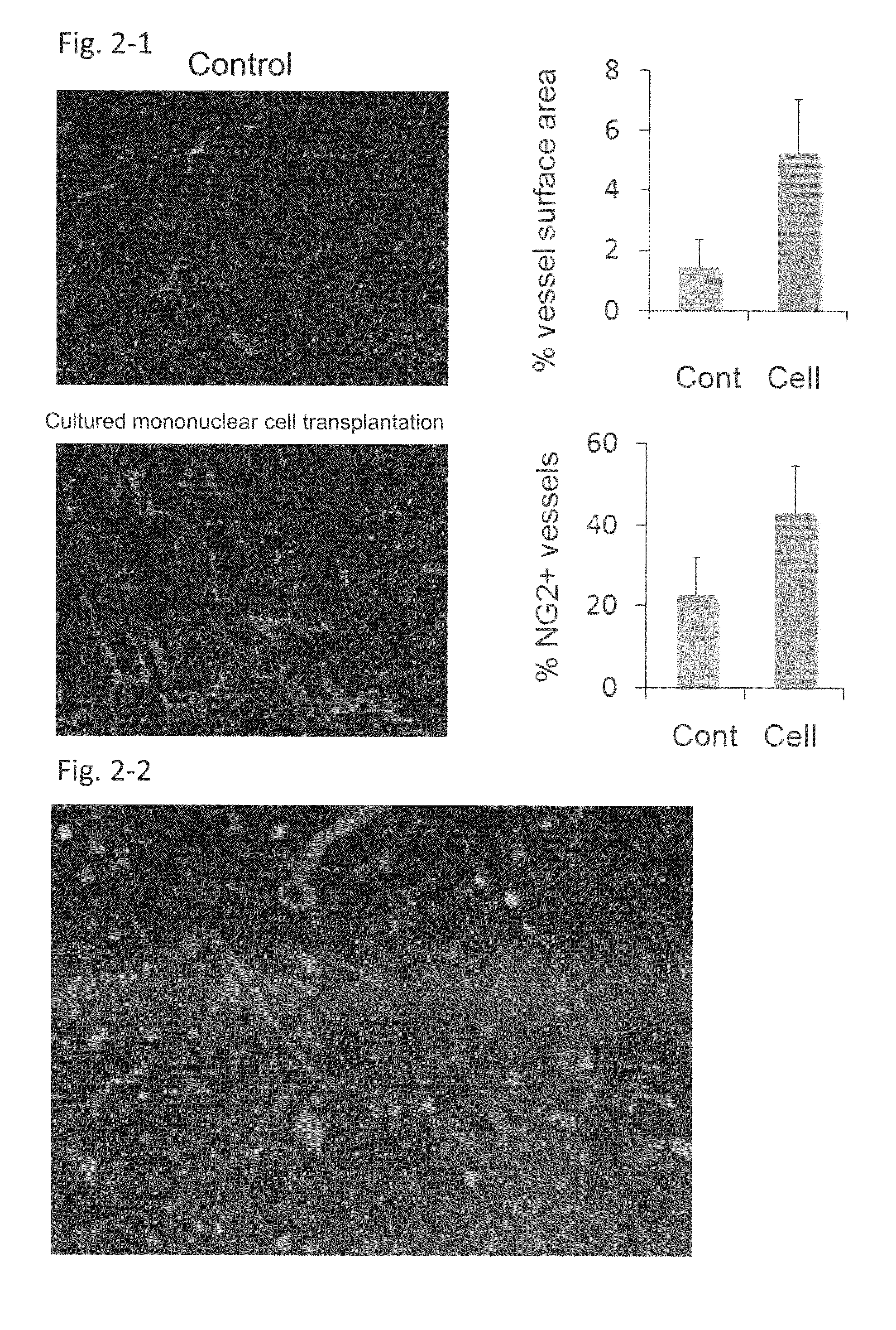 Revascularization cells derived from mononuclear cells, and method of inducing differentiation thereof
