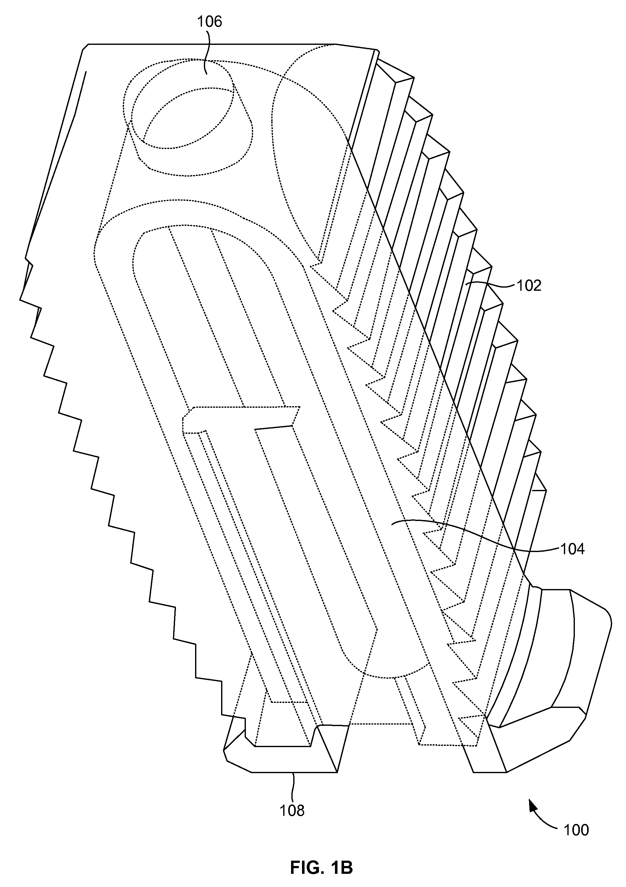 Compliant interbody fusion device with deployable bone anchors