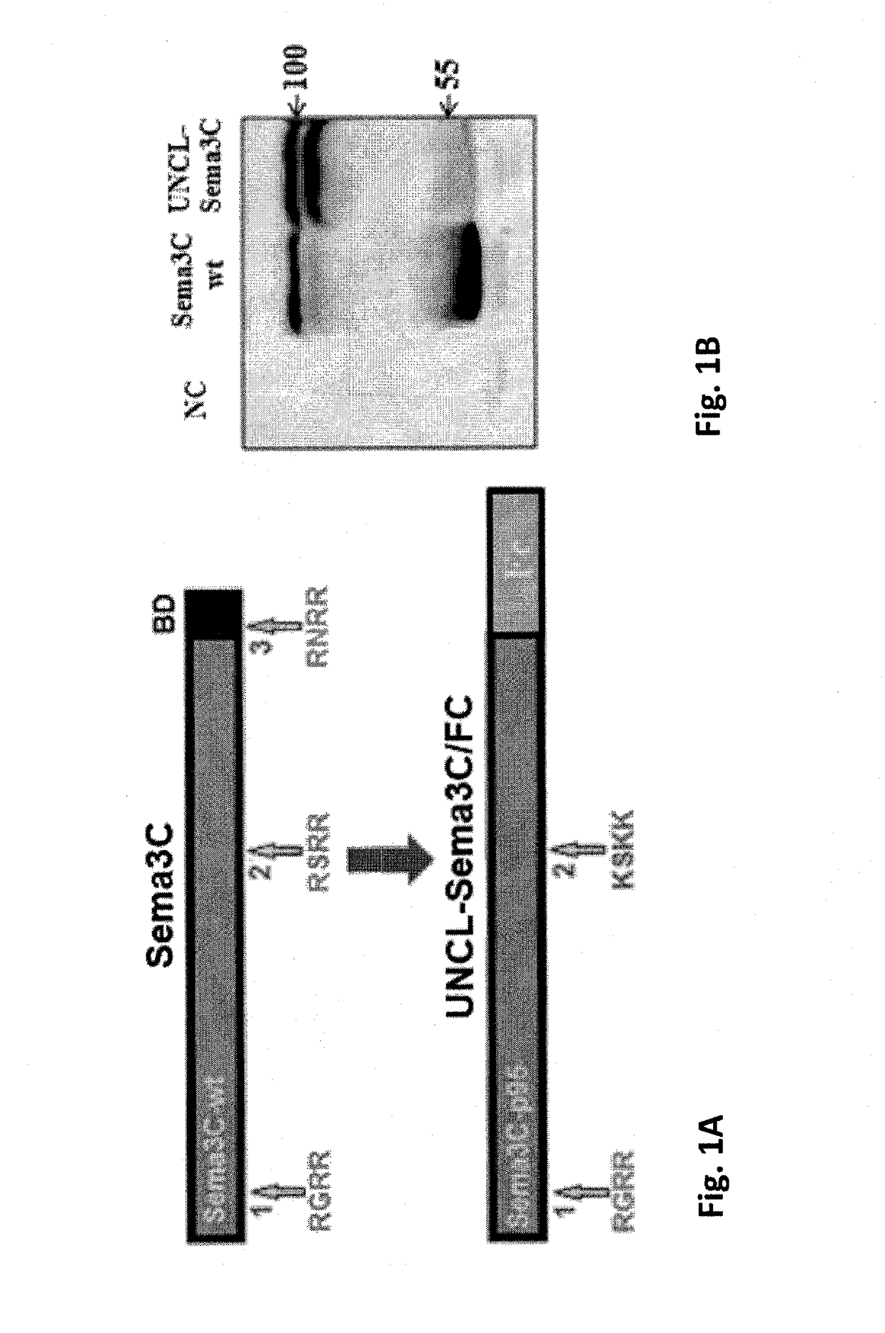 Semaphorin 3C variants, compositions comprising said variants and methods of use thereof
