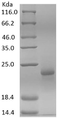 DNA sequence encoding African swine fever virus antigen, composition of antigen encoded thereby and use thereof in immunological detection