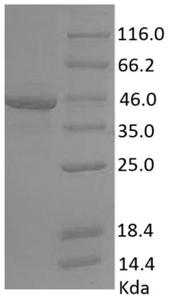 DNA sequence encoding African swine fever virus antigen, composition of antigen encoded thereby and use thereof in immunological detection