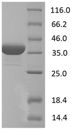 DNA sequence encoding African swine fever virus antigen, composition of antigen encoded thereby and use thereof in immunological detection