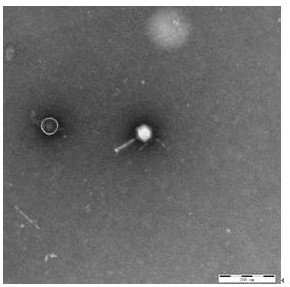 Bacteriophage vB_Yen_X1 and application thereof in prevention and treatment of Yersinia pestis infestation