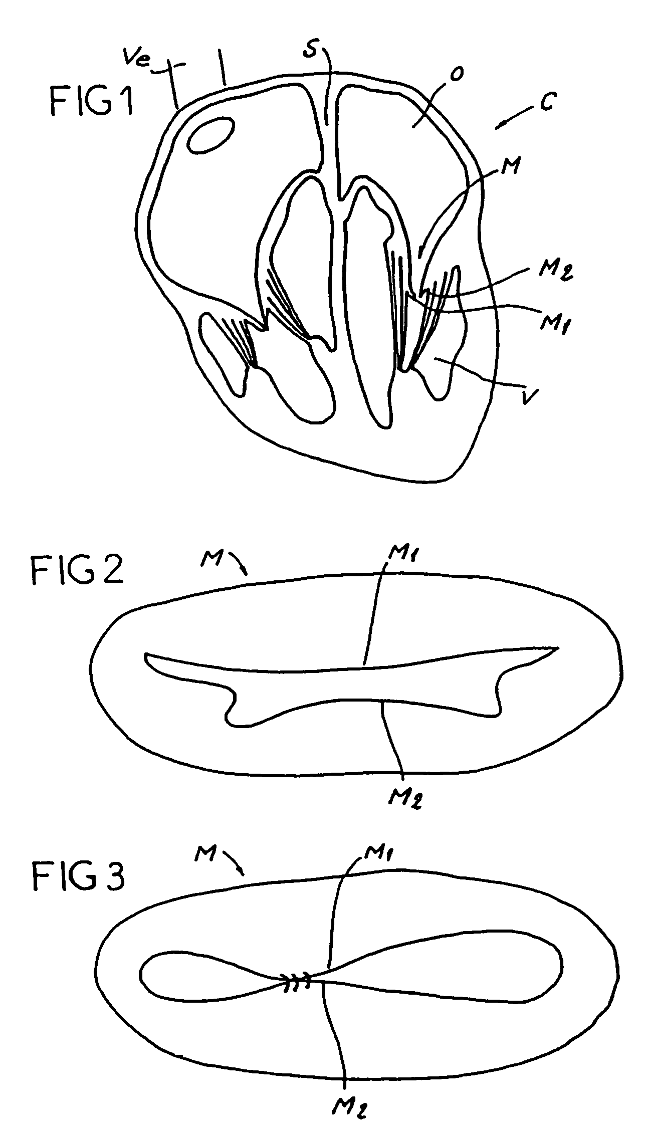 Surgical device for connecting soft tissue