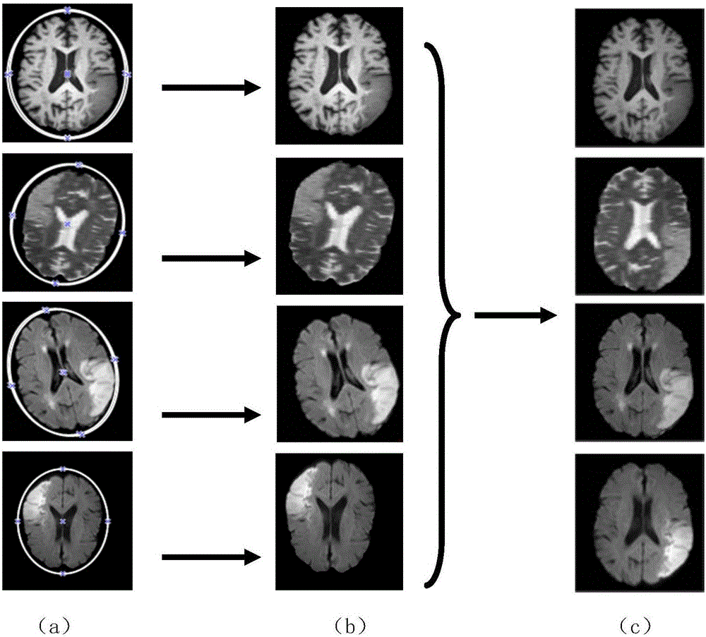 Multi-modal brain-image injured pathological tissue image segmentation method