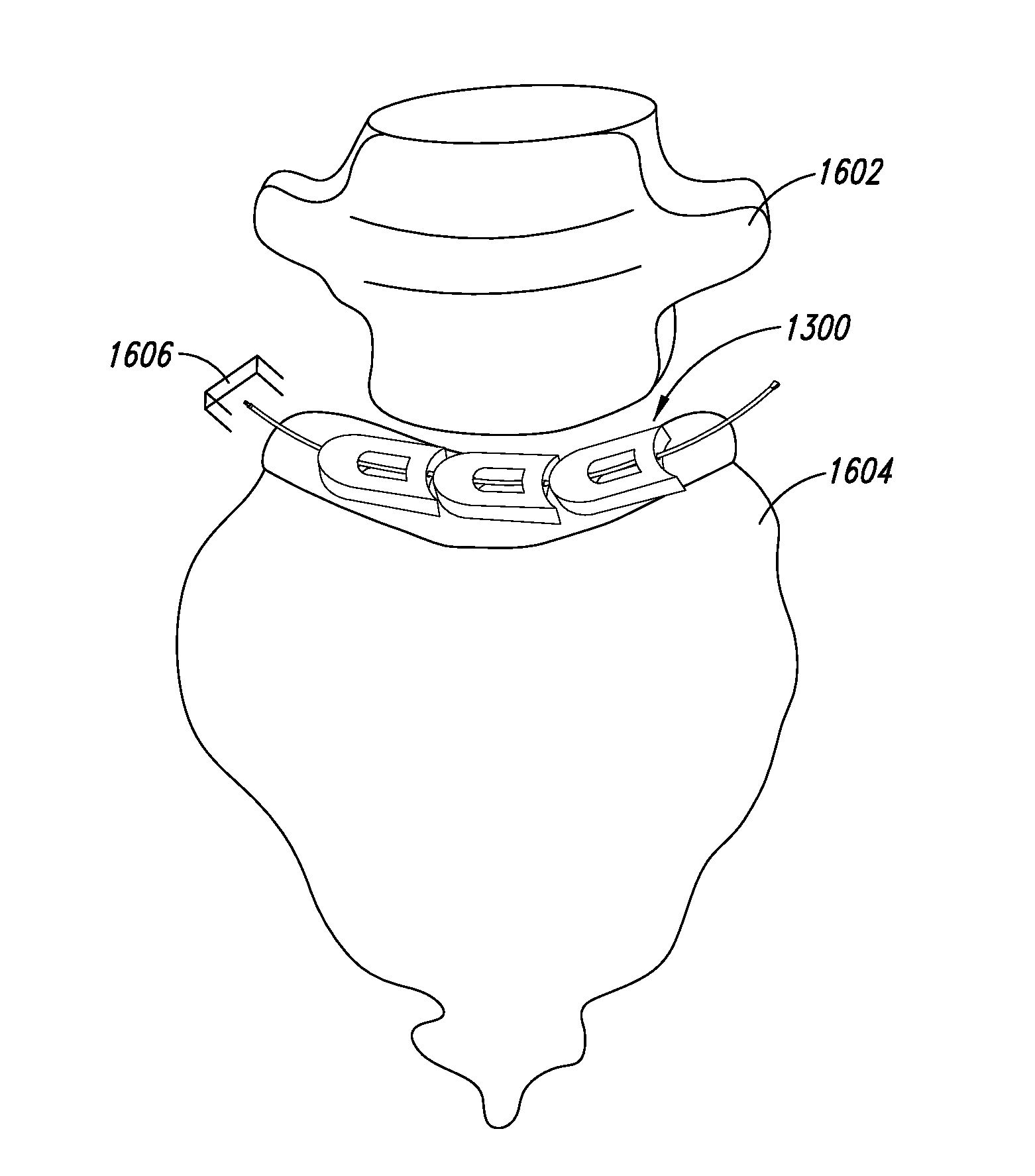 Devices and approach for prone intervertebral implant