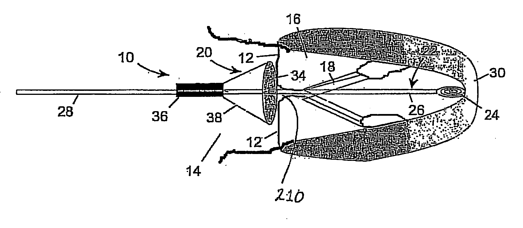Medical device suitable for use in treatment of a valve