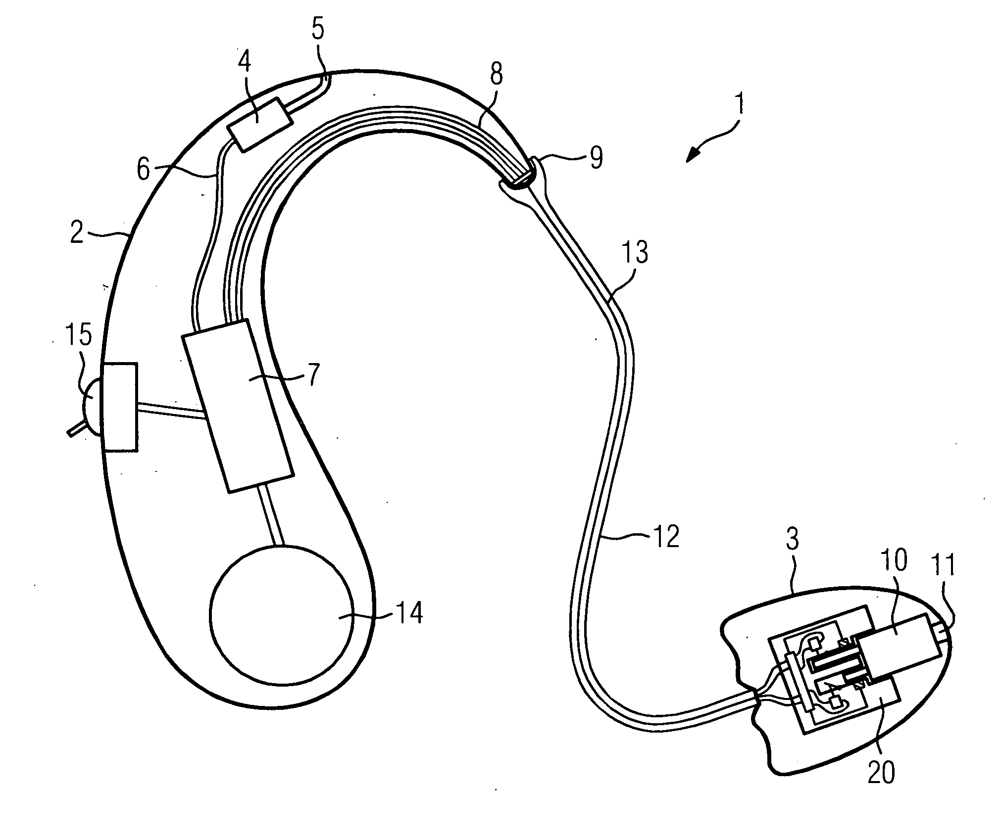 Automatic identification of receiver type in hearing aid devices