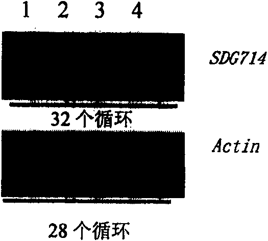 Histone methylated transferase and its encoding gene and application