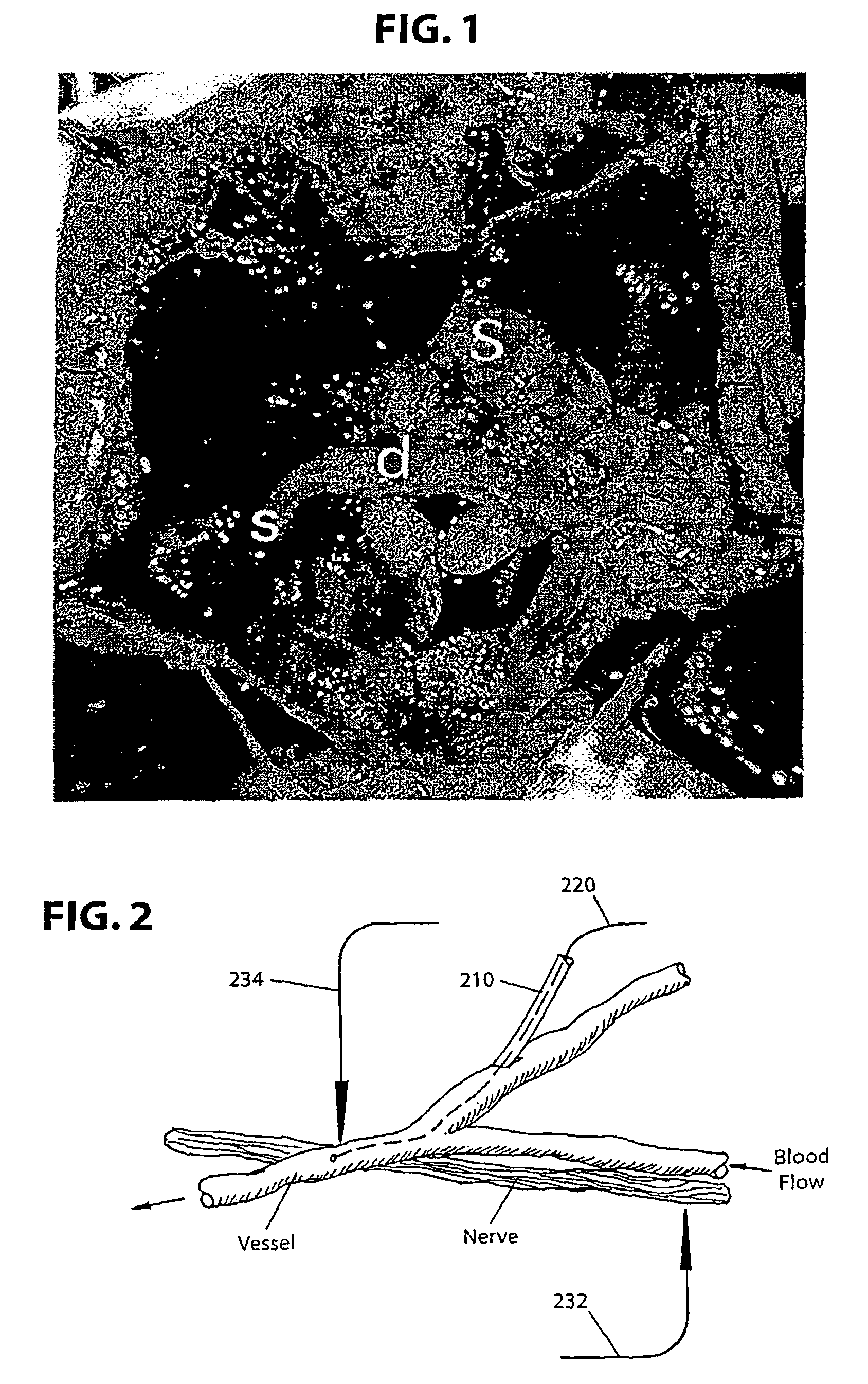 Brain-machine interface systems and methods