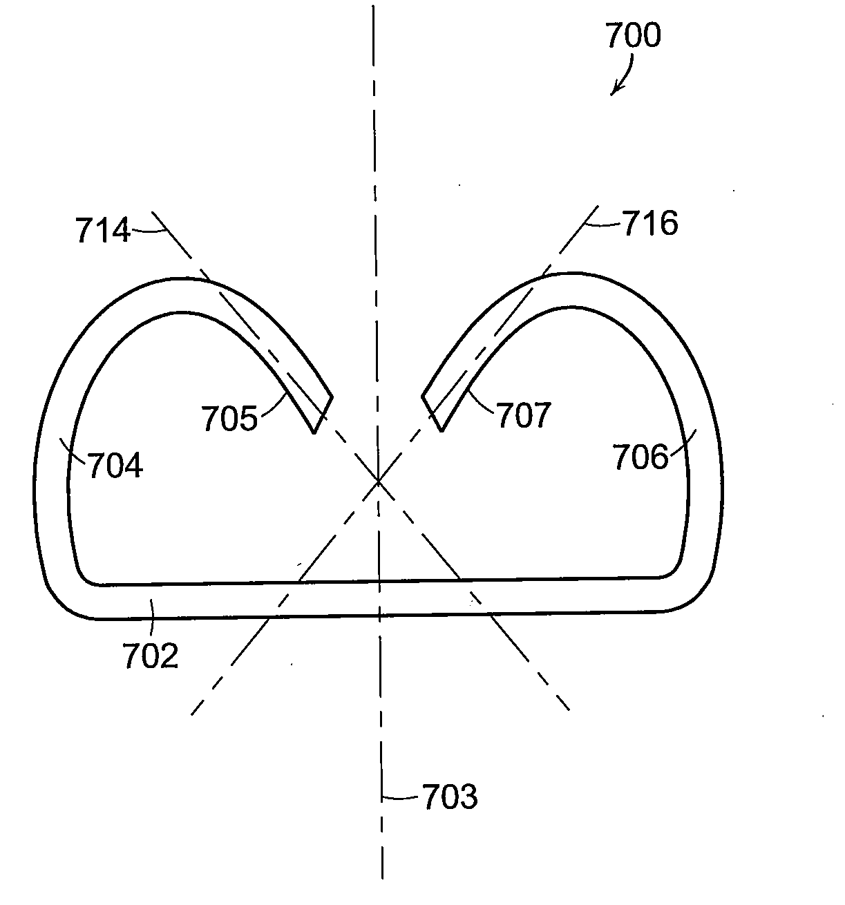 Method for forming a staple