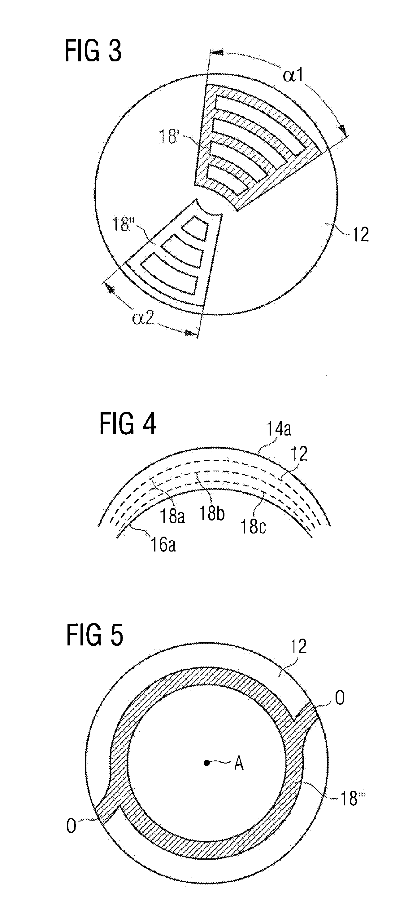 Device for dissecting an eye for the introduction of photosensitizer and method of refractive surgery