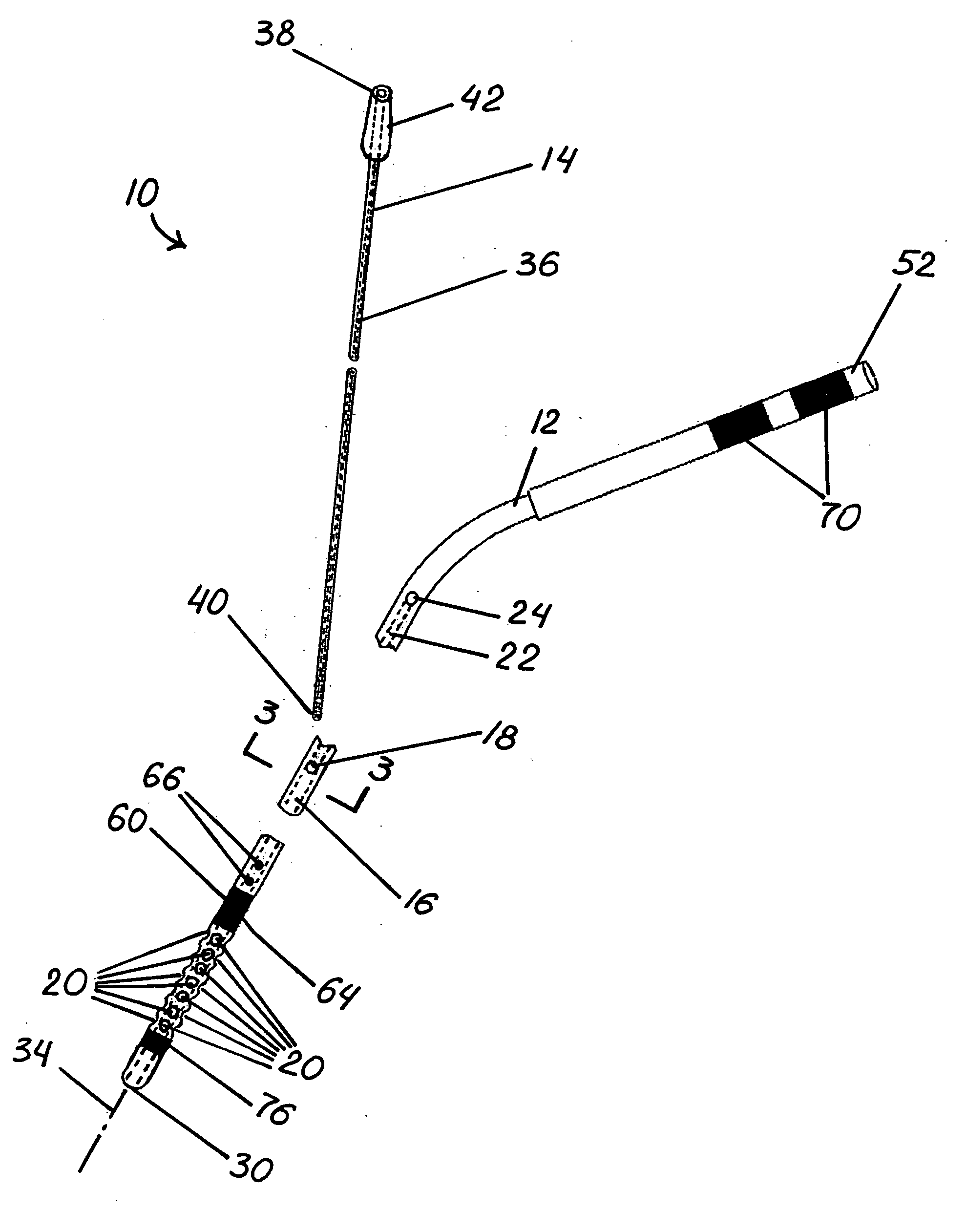 Catheter assembly for intracranial treatment using dual lumens