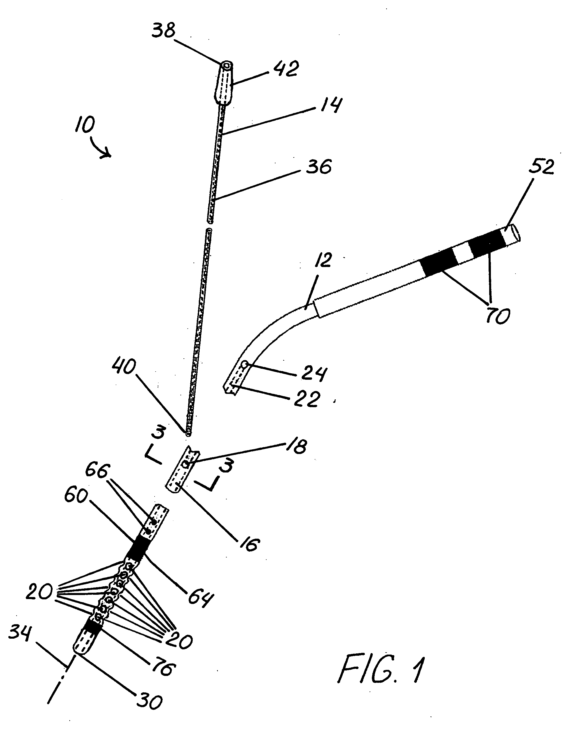 Catheter assembly for intracranial treatment using dual lumens