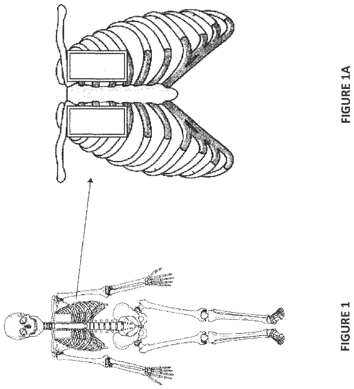 Apparatus and method for a heating patch