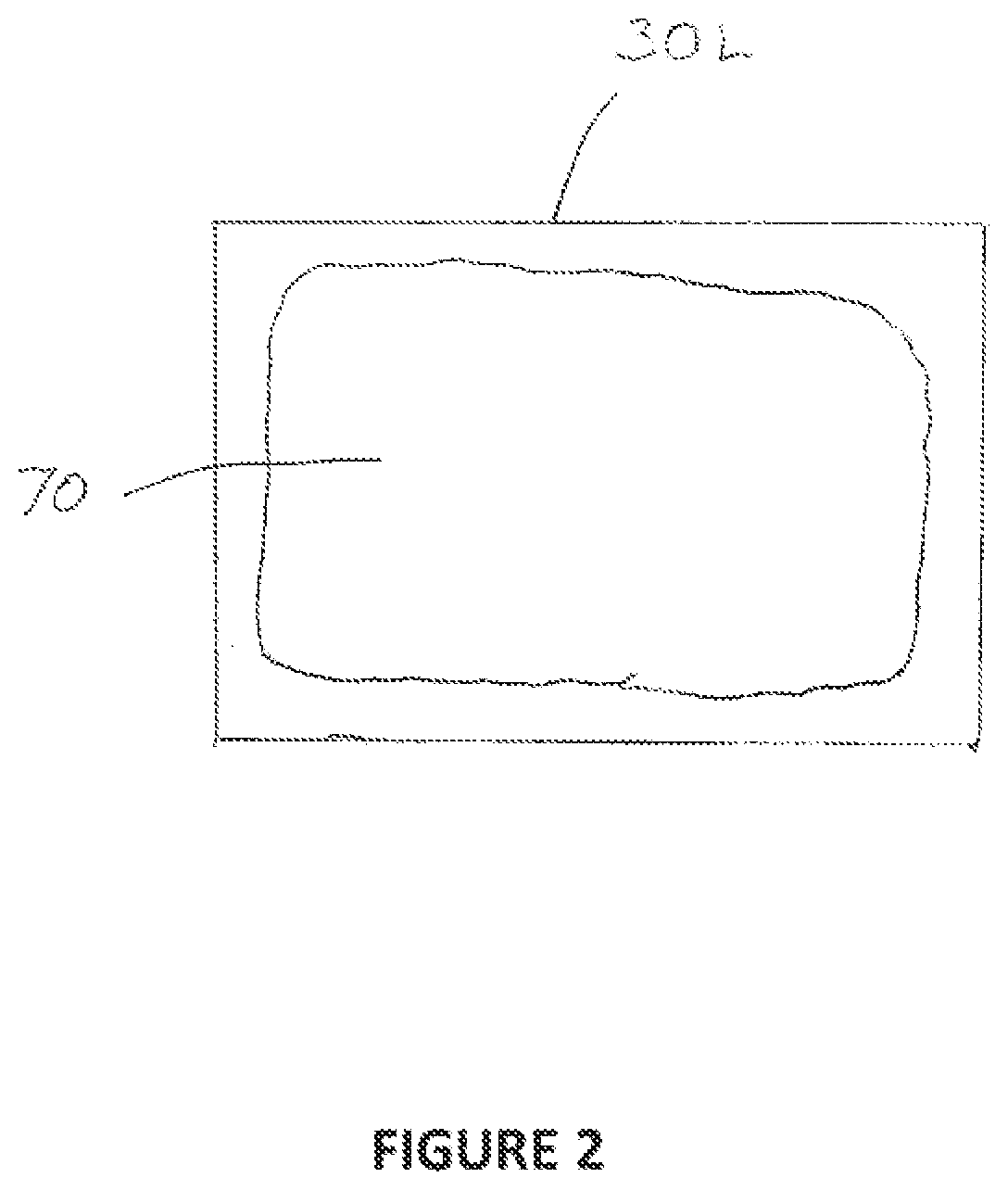 Apparatus and method for a heating patch