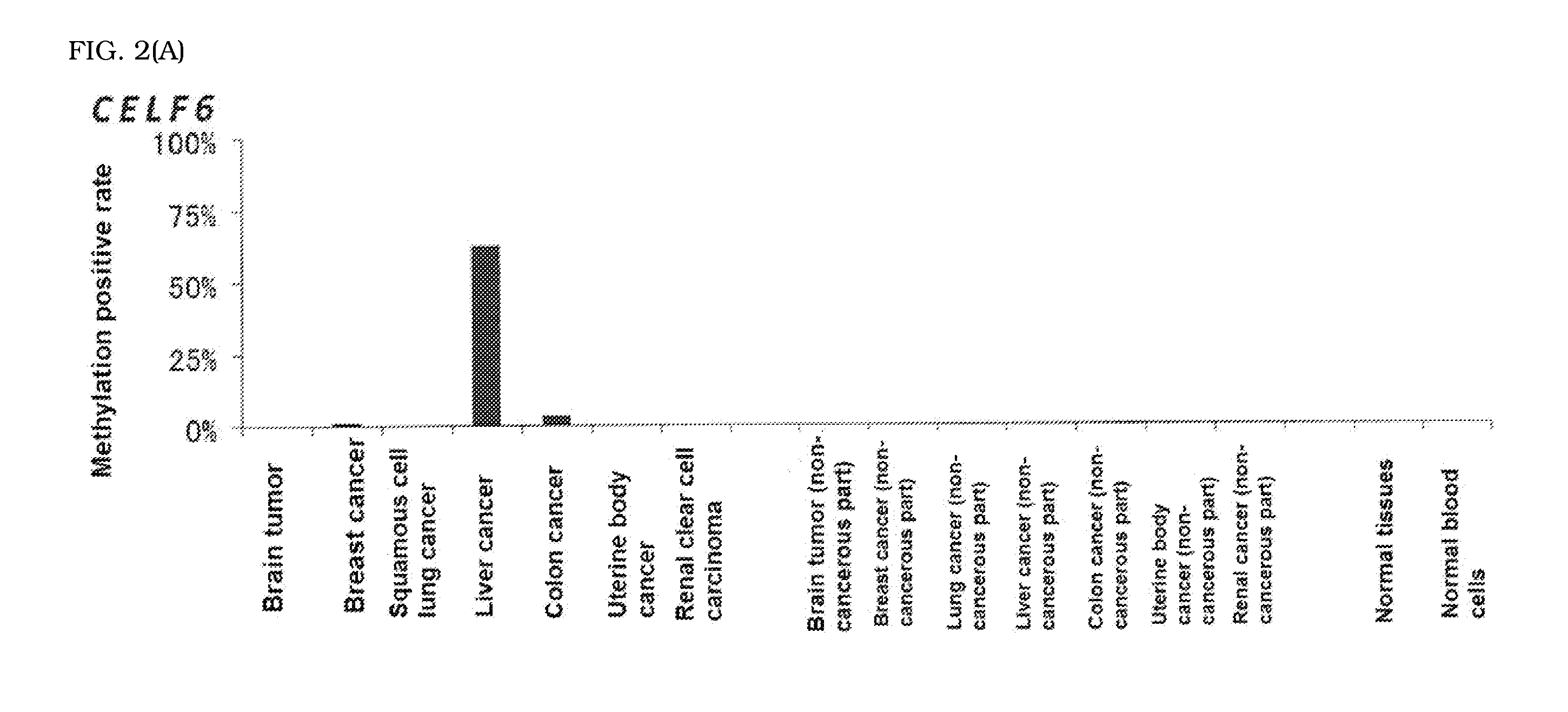 Computer readable medium for enabling a computer to carry out provision of information on hepatocellular carcinoma and marker and kit for obtaining information on hepatocellular carcinoma