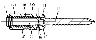 Nail bar correcting support assembly used for scoliosis