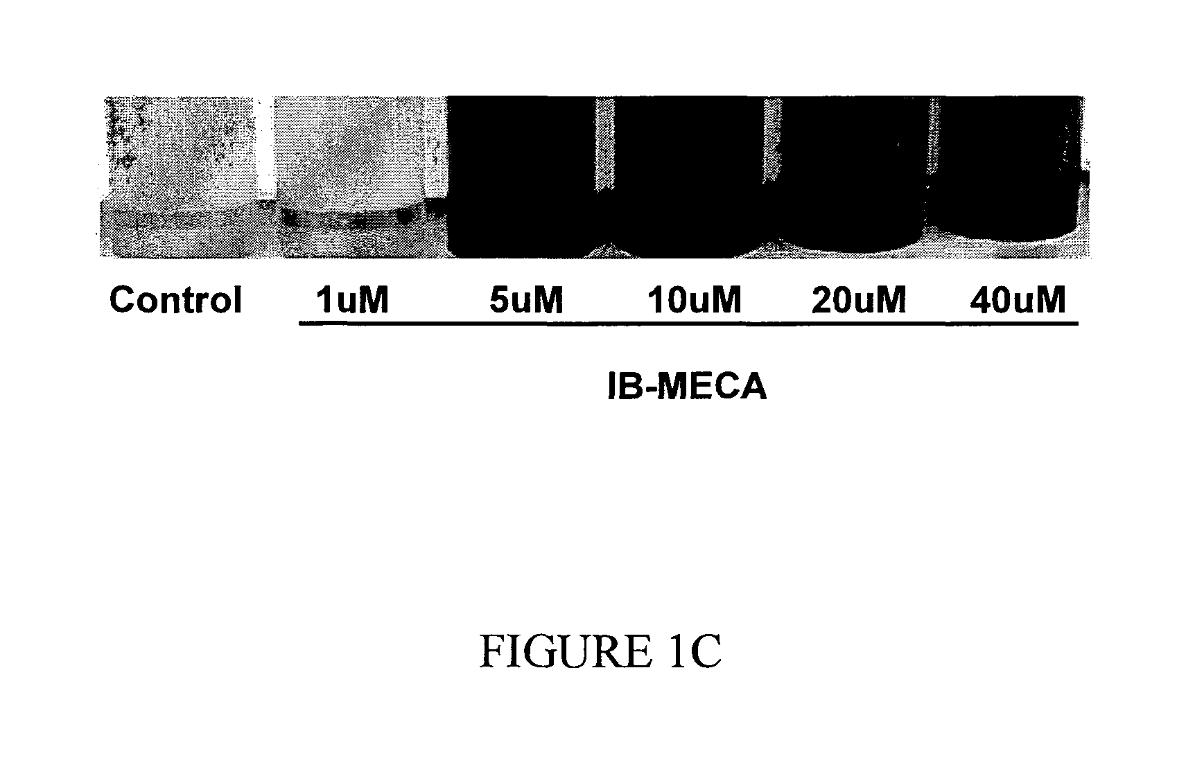 A3 adenosine receptor ligands for modulation of pigmentation