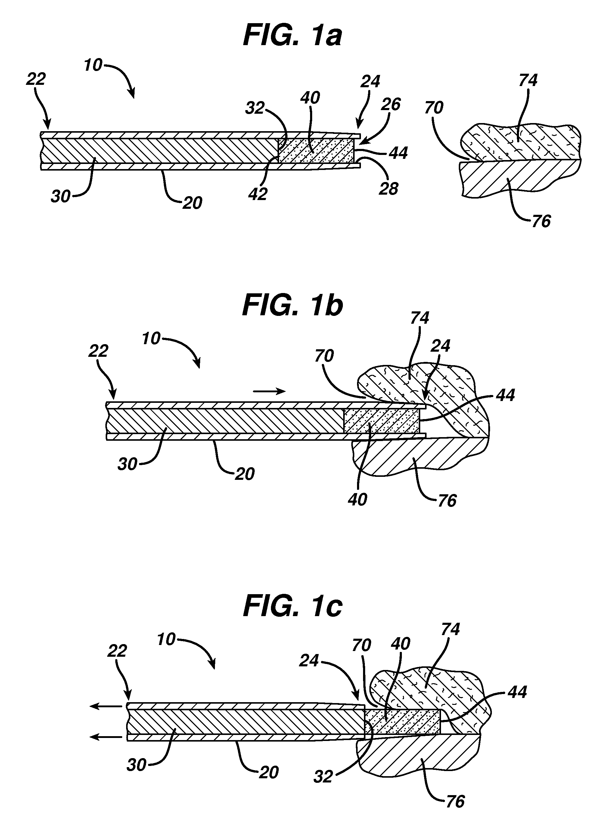Actuators for device for delivering medicinal implants