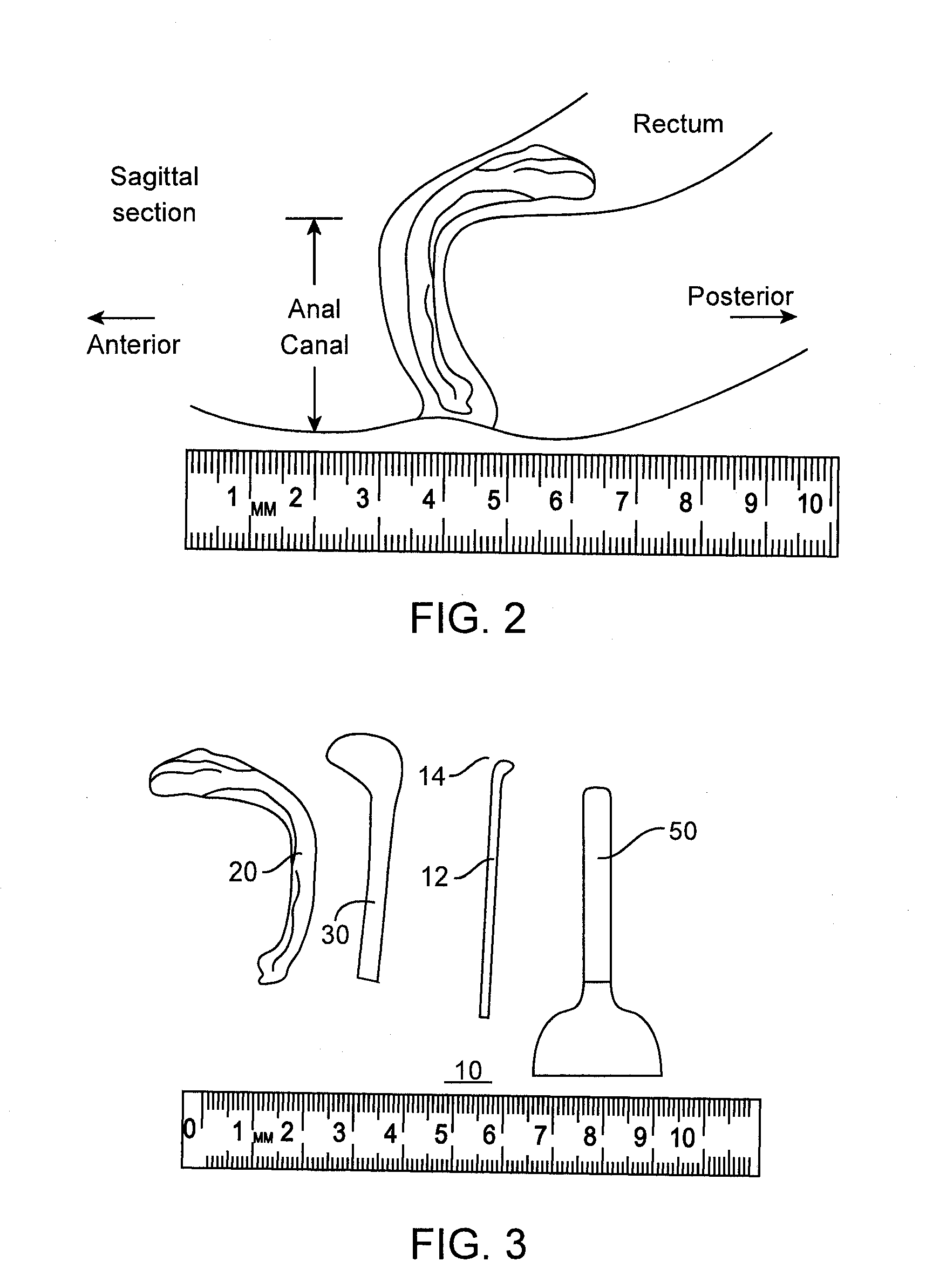 Fecal incontinence device, system and method