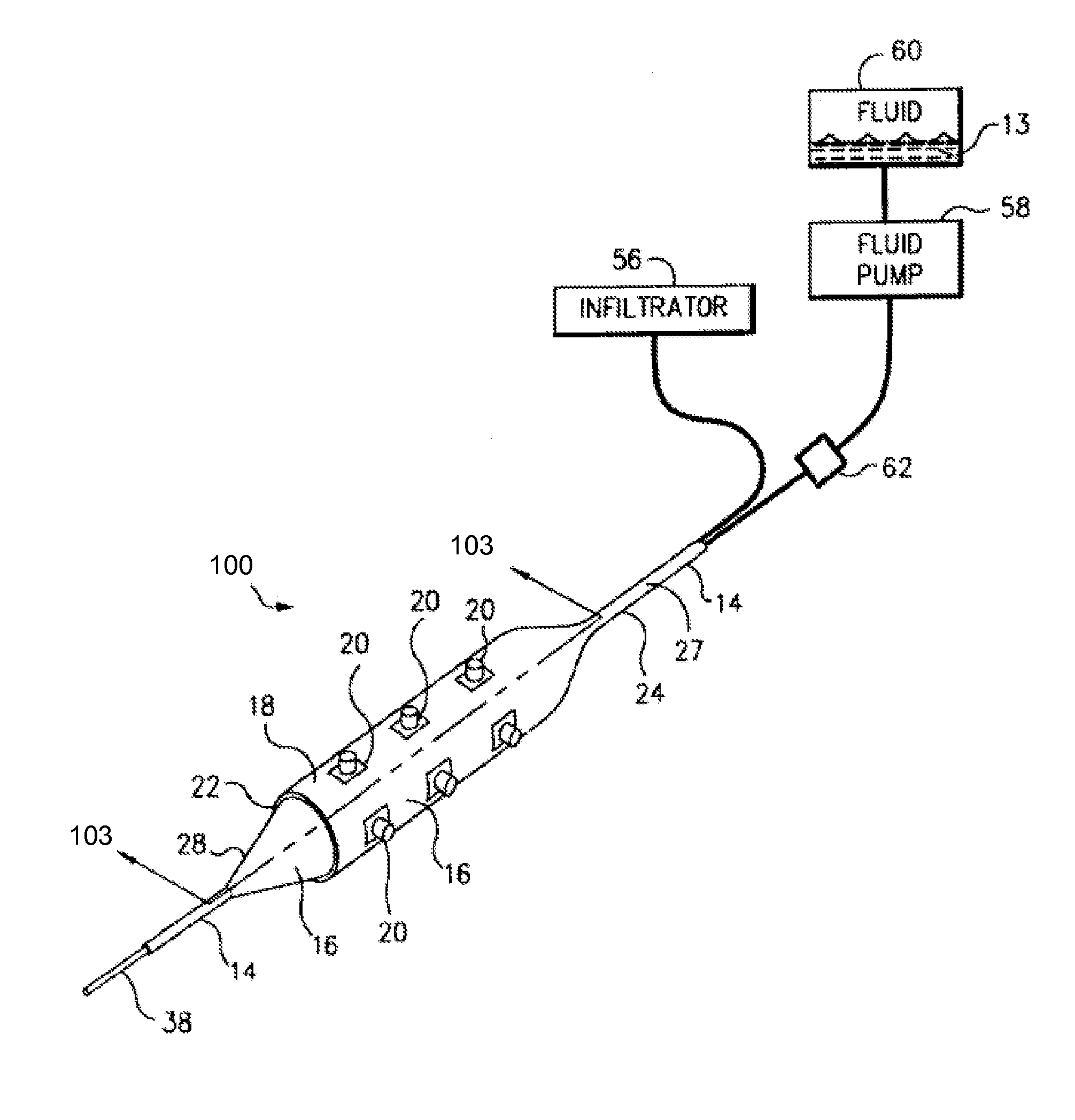 Method for delivering medication into an arterial wall for prevention of restenosis