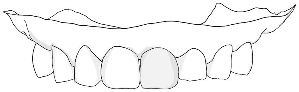 A virtual temporary abutment and its construction method and system for a grinding guide