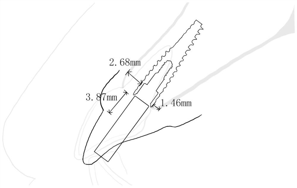 A virtual temporary abutment and its construction method and system for a grinding guide