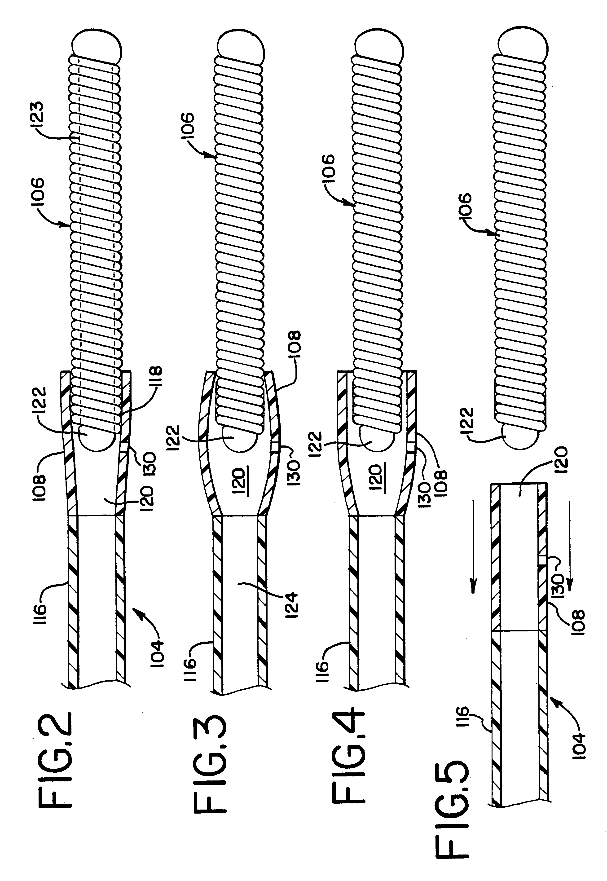 Embolic coil hydraulic deployment system with purge mechanism