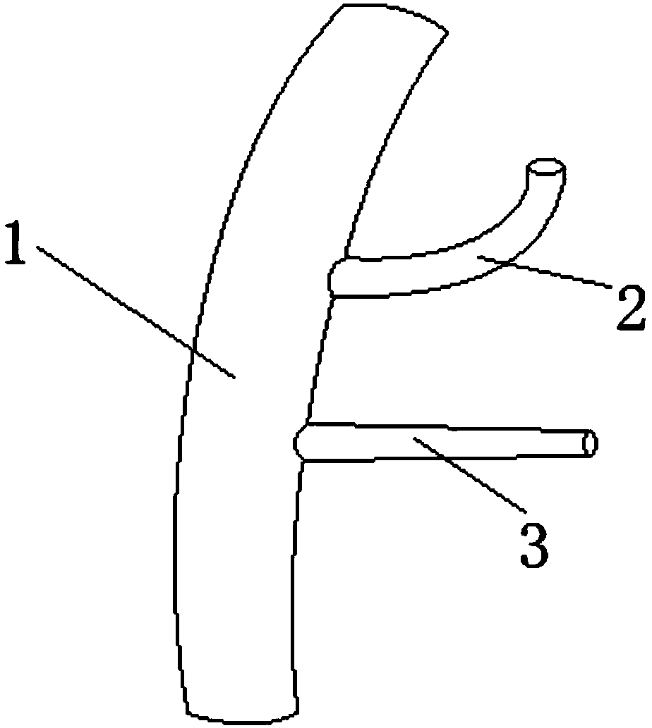 Gastrointestinal Connectors for Gastrointestinal Reconstruction in Duodenectomy