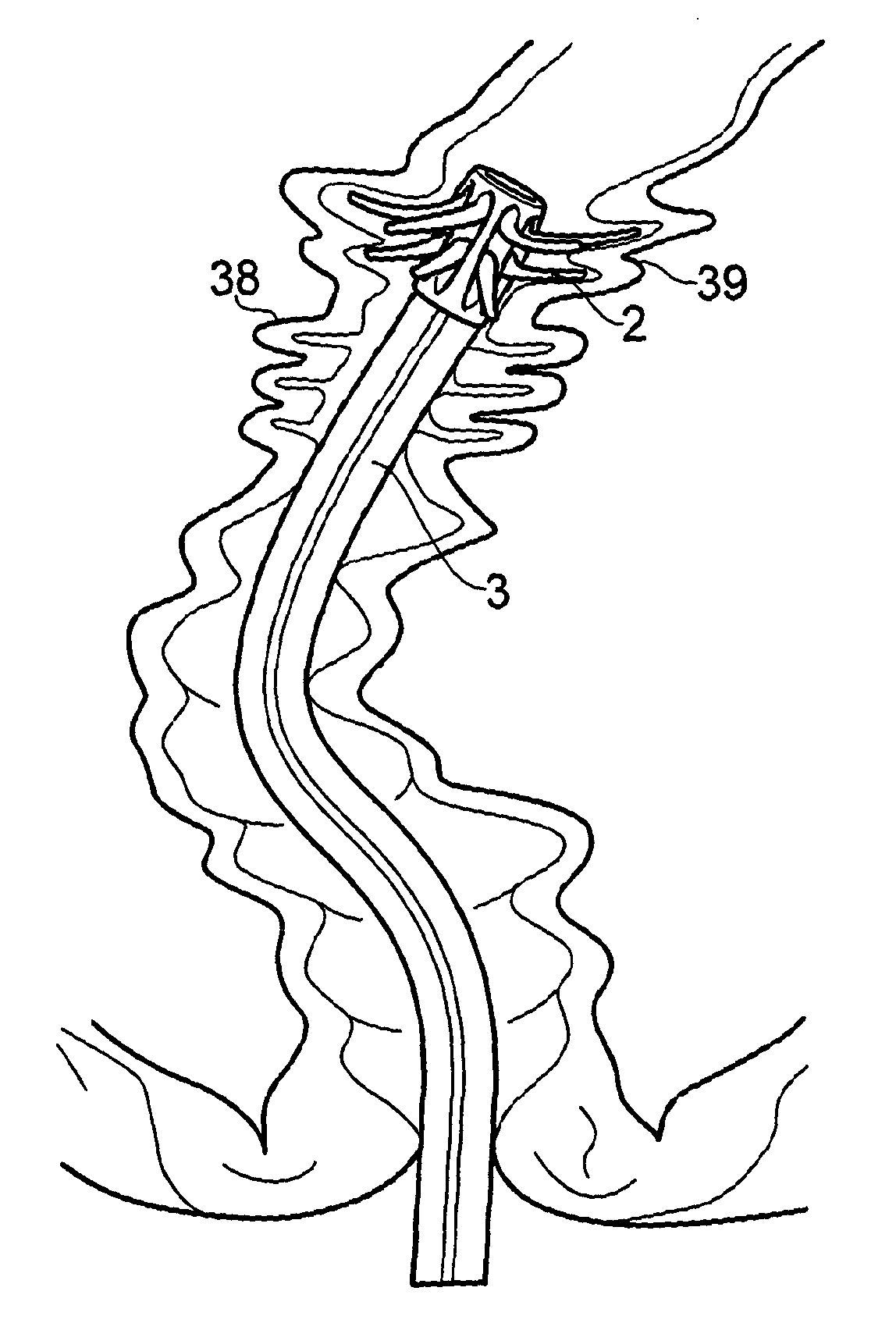 Covering for a medical scoping device
